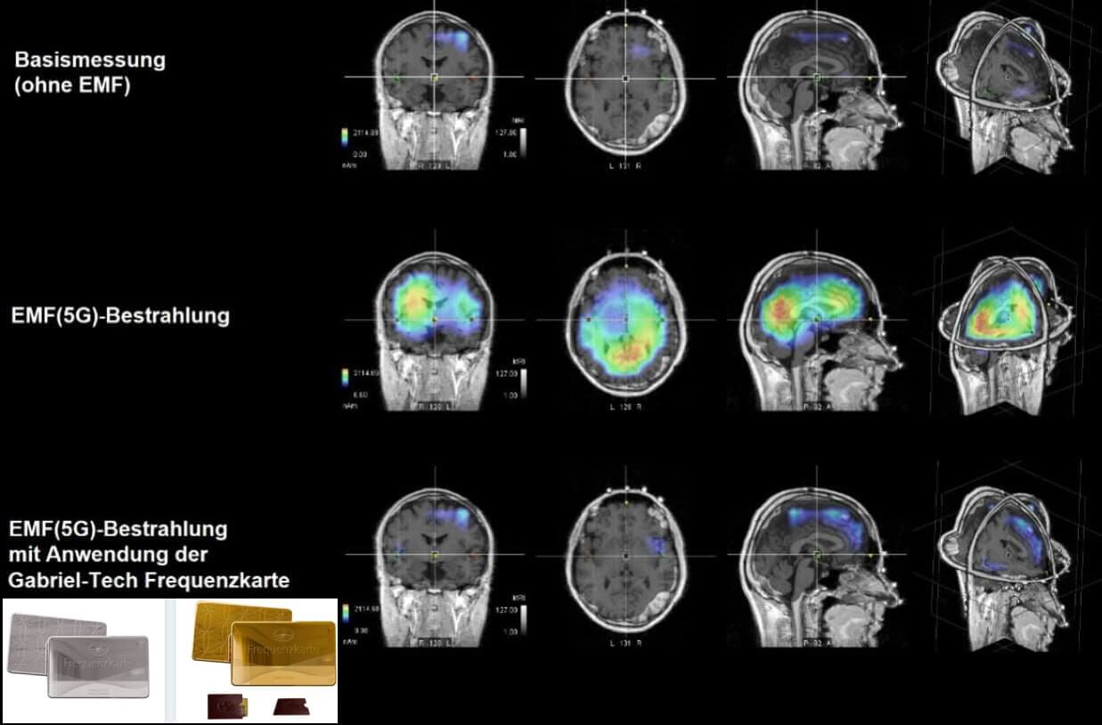 Elektrosmog Frequenzkarten